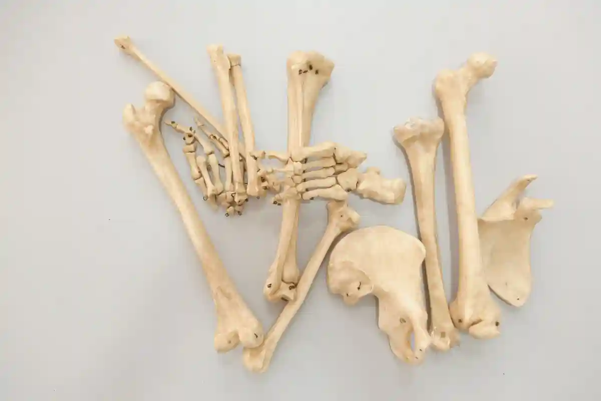Ilustrasi tulang tulang jenazah.