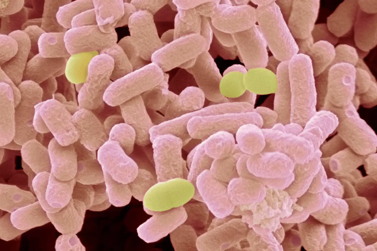 Bakteri Escherichia coli
